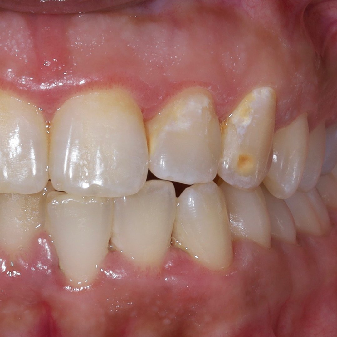 Before — Dr. Noora Al-Otaibi